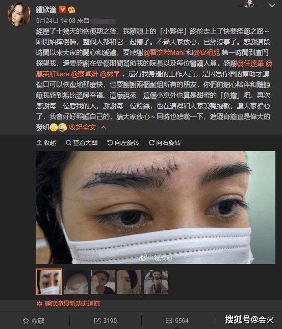 赖弘|原创阿娇突晒视频感性发文：感谢你曾经来过，开滤镜后脸上找不见伤疤