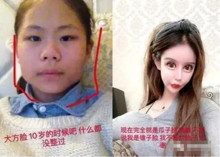 妖孽|Do4次鼻子开5次眼角花400w换头！这张妖孽脸看得我头皮发麻…