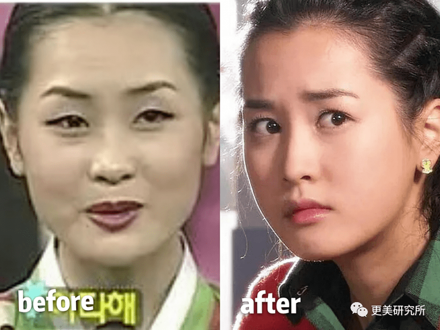 do|贵圈削骨图鉴 | 三代100个女星同时削掉半张脸、杨幂竟还垫底...