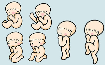 颜无痕小课堂:胎儿横位的妈妈该怎么睡觉