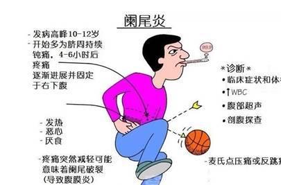 古代阑尾炎怎么办