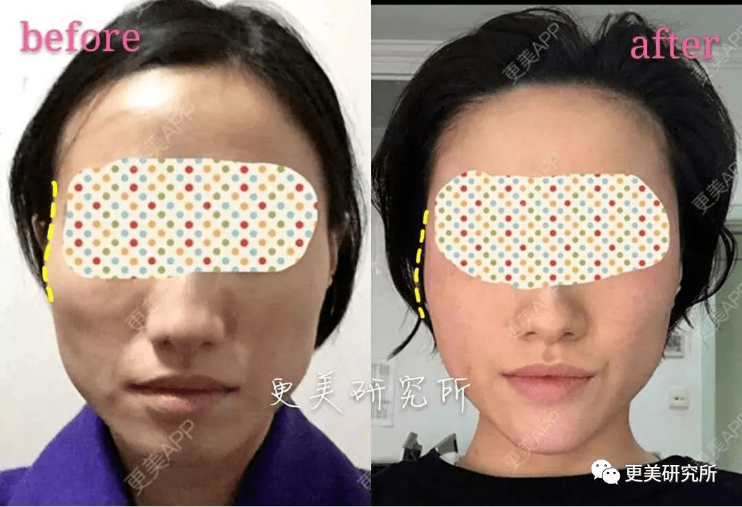 亚太|组团换头诈骗，居然成为亚太第一女团！10年修补，难回巅峰？