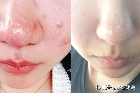 肌肤|水光语|为什么我已经认真护肤了，皮肤却还不见好转？