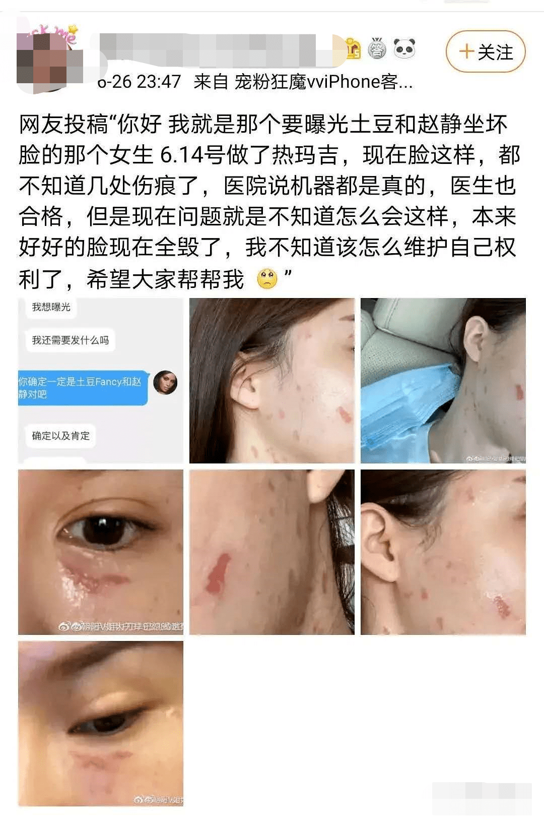 土豆|自己整成馒头脸,还教粉丝瞎整,她这不是第一次翻车了…