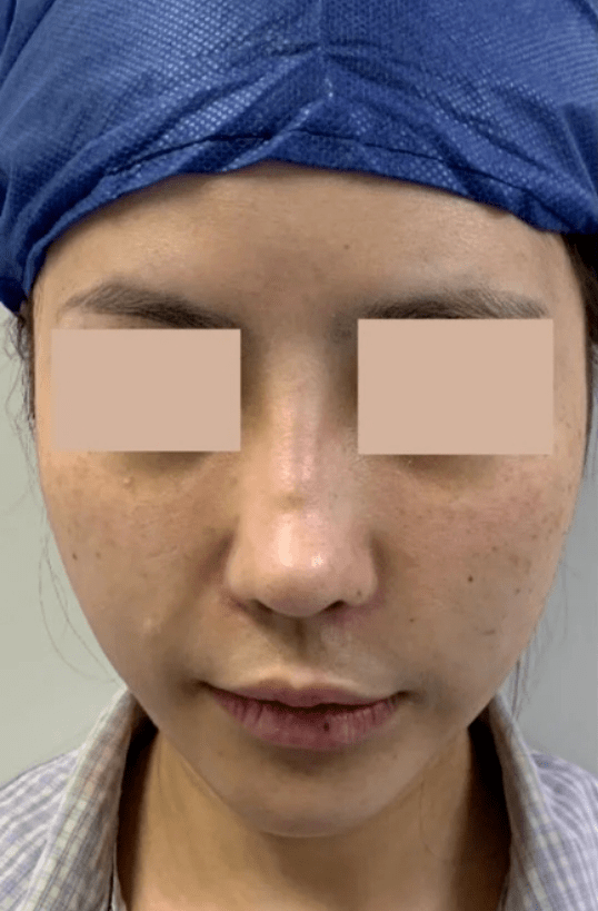 土豆|自己整成馒头脸,还教粉丝瞎整,她这不是第一次翻车了…