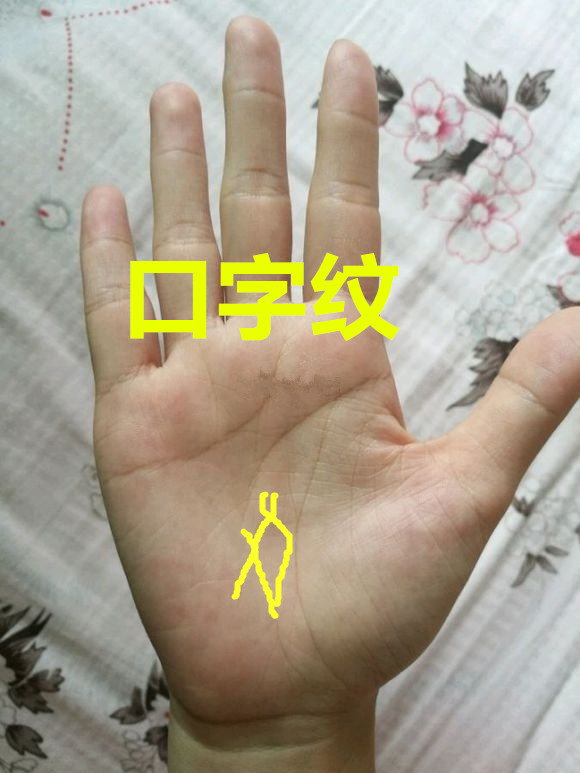 人口断掌比例_断掌图片