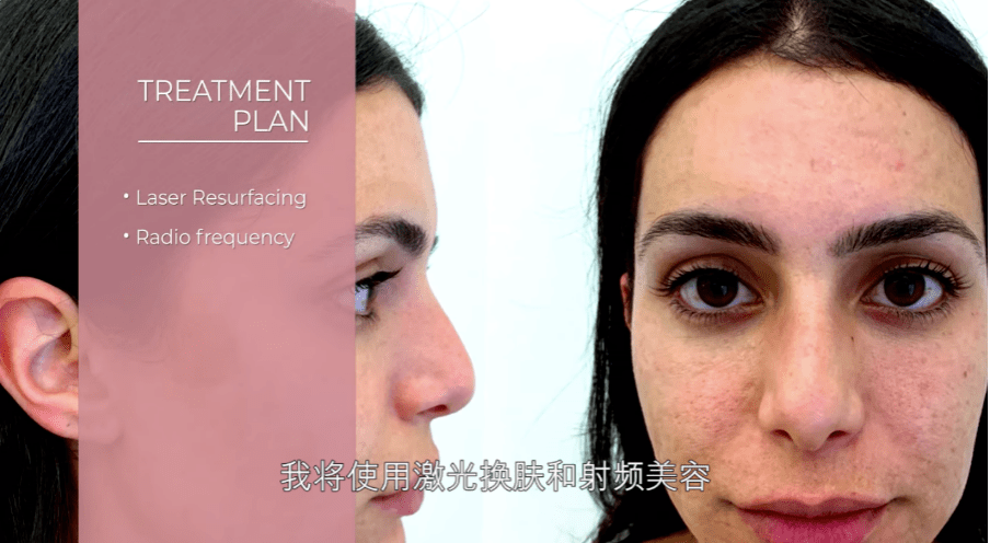 类节目|《皮肤救兵》,让变美成为一种自我表达