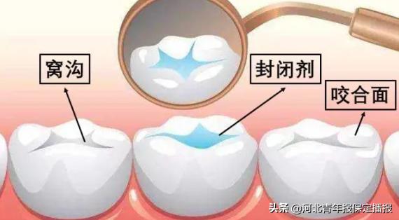 牙齿|孩子牙疼吃不下饭？保定牙博士教你护牙＂正确姿势＂