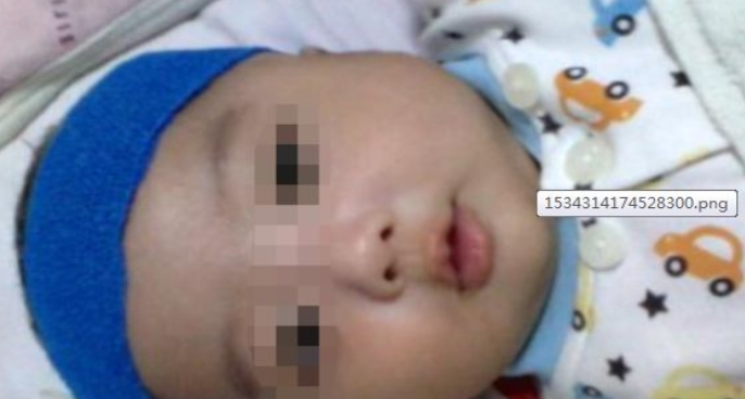 几个月可以查出来孩子畸形 d0e0b6d944f747c6a127fca6d1c7078d.jpeg