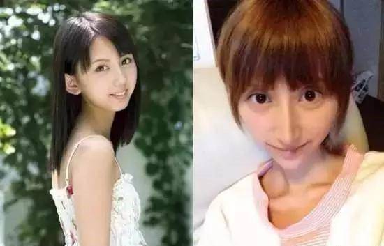 资产|坐拥上亿资产，选择顶级整形医院，整容就一定会成功吗？