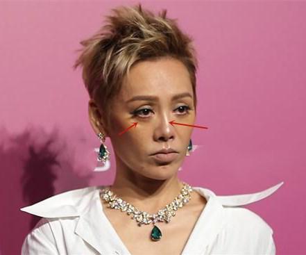 宁静|宁静出席活动挑错妆容，土黄色肤配超短发，脖子和脸颜色不一