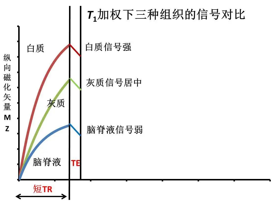 用实例分析磁共振加权成像