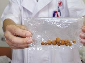 肾结石是怎样引起的呢 2de7327ed66b45a6a02e5d2c31dc93de.jpeg