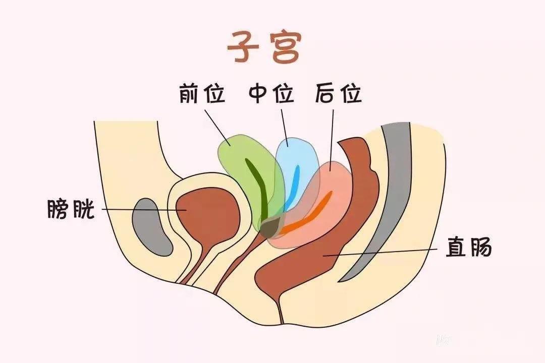 移植前宫腔积液怎么办