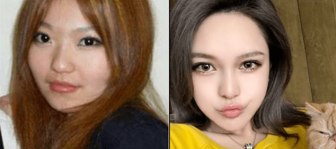 赵丽颖|鞠婧祎和赵丽颖竟然是同一个医生？