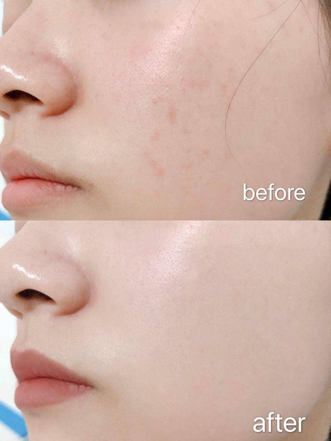 肌肤|护肤油真的很有油吗？抹油真的很快乐，特别是在现在