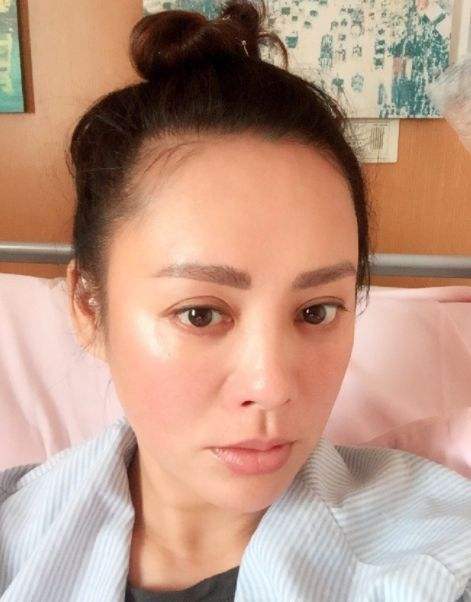 按摩|“瘦成一座雕塑”的宁静，在护肤上更是个狠人，为变美扎900针