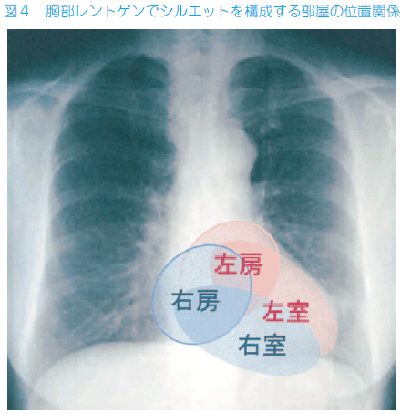 jmt独家日本治疗心脏肥大的深度解析报告