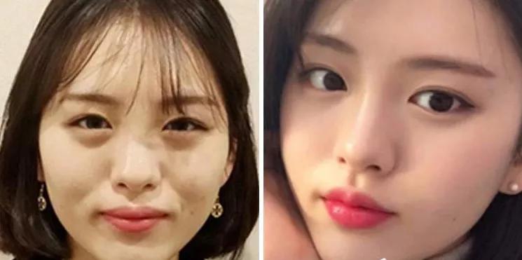 李惠利|女明星最绝大鼻头变身记！娜扎do鼻子前应该找她取经1000次...