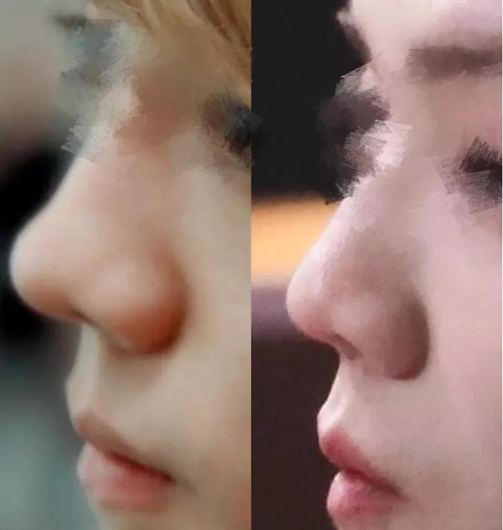 毛孔|权志龙，你真的不能再整了啊...