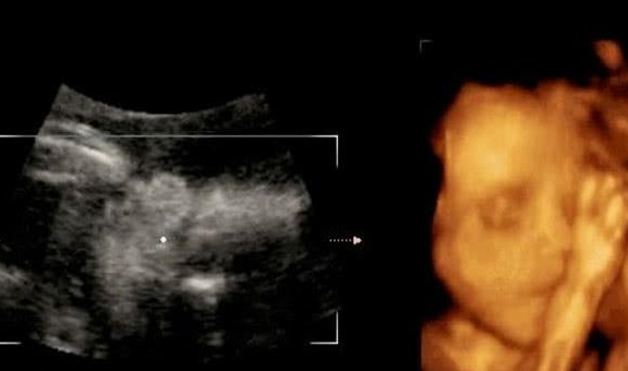 几个月做四维好呢 851306dfa02c403ab220dfca835c6098.jpeg