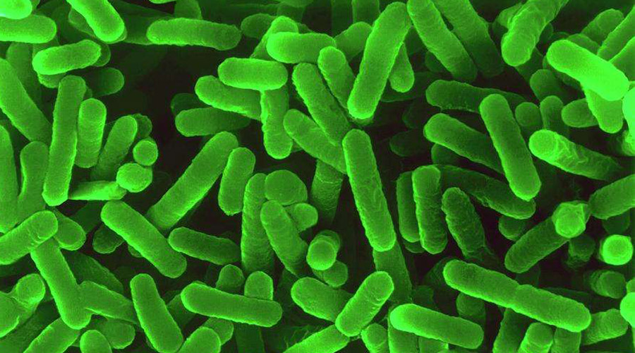 造成桶装水铜绿假单胞菌超标的原因和解决方法 | 二氧化氯