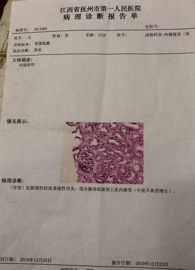 万先生2019年12月胃镜病理诊断报告