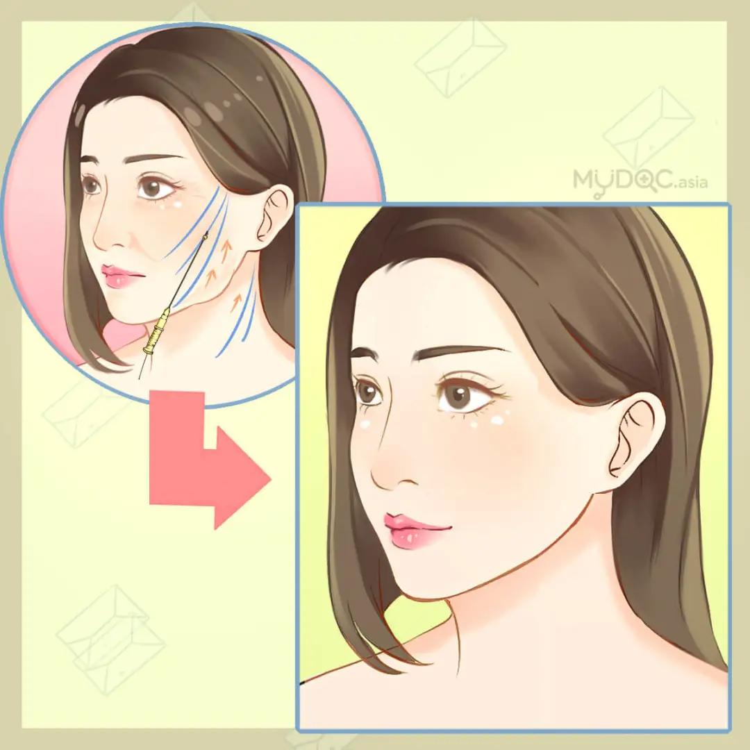 老脸|金晨谈恋爱也太尴尬了！节目组卖力撮合个寂寞……这张不老脸就能胡作非为吗？