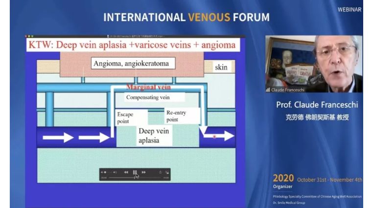 治疗|开幕第一天精彩回顾｜2020国际静脉病论坛持续进行中