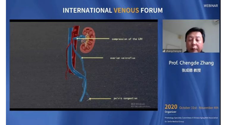 治疗|开幕第一天精彩回顾｜2020国际静脉病论坛持续进行中