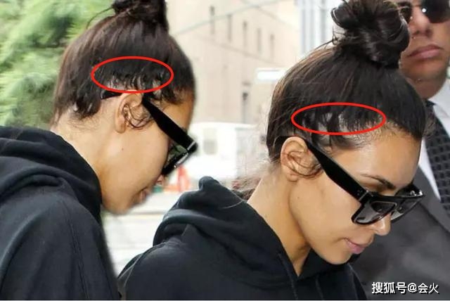 孟佳|孟佳自曝戴假发片，金莎直言发量作弊是常态，女艺人怎么都秃了？