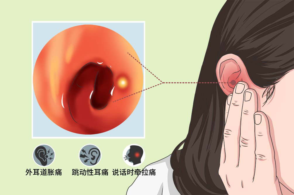贵阳铭仁耳鼻喉医院科普什么耳朵里也会长痘痘小心是外耳道疖肿
