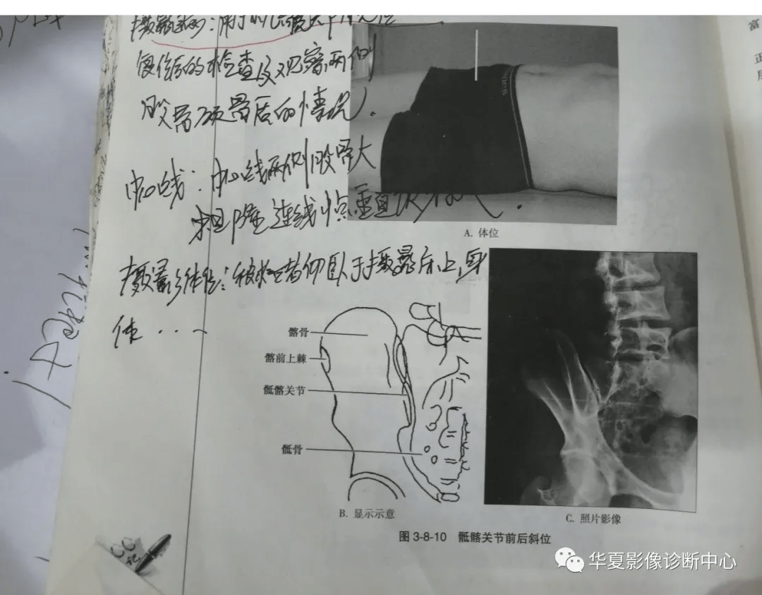 医用放射设备 dr 摄影目录