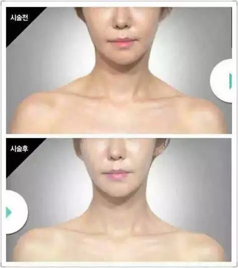 怎样瘦脸瘦身材 672d3f8ef0d24cb48519e403c7e9de2e.jpeg