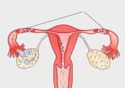 用什么方法可以不怀孕 d648bd92cea642f4843566848b7d36c7.jpeg