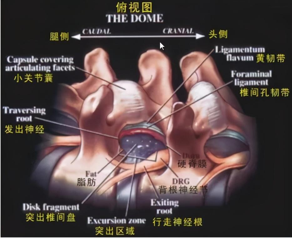 椎间孔解剖图