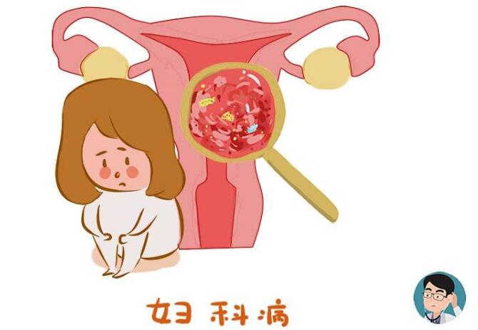 女人出现3个异常,或是宫颈癌到来的信号,不能拖,及时检查