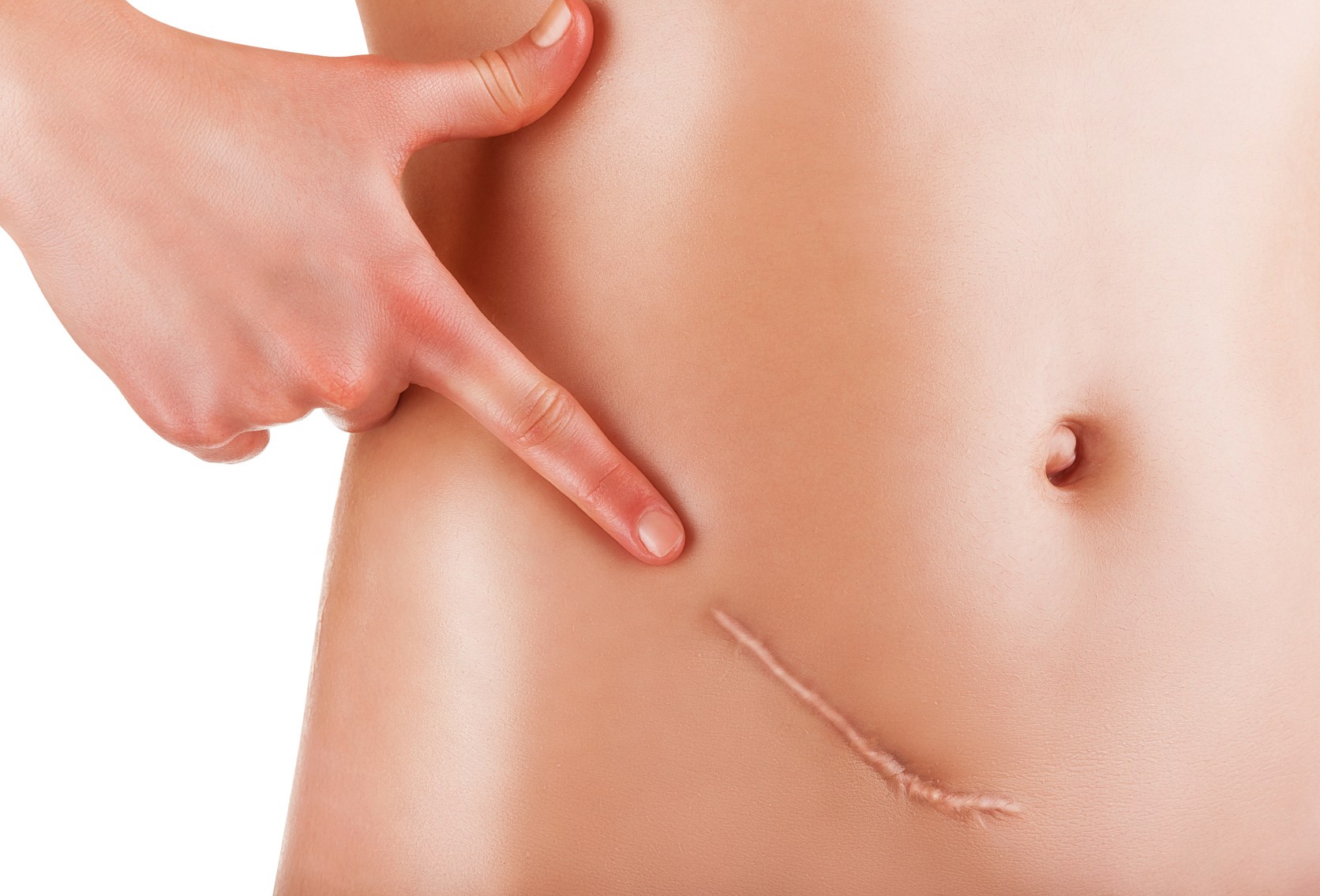 疤痕为什么会增生?会有哪些危害?