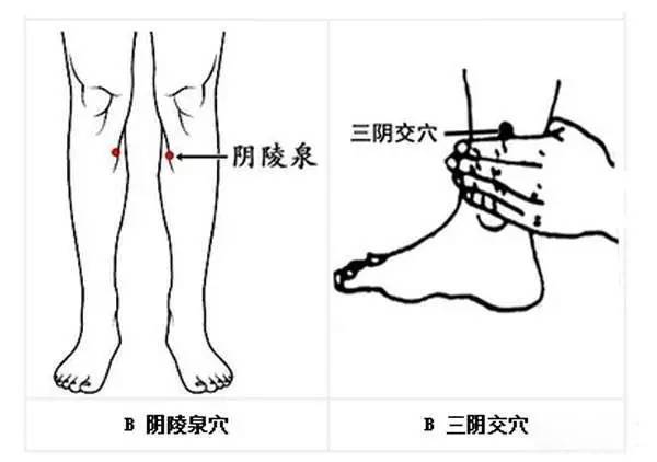 慢性前列腺炎的拔罐疗法