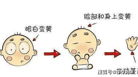 新生儿生理性与病理性黄疸是需要不同程度的照顾,您知道吗?