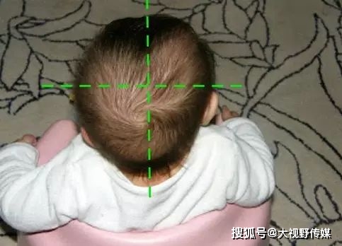 头颅|后果不堪设想！还在给宝宝睡头型？小心睡成头颅畸形