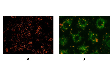jc-1 检测线粒体膜电位(membrane potential)原理
