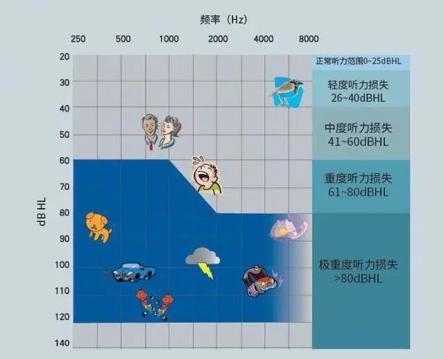 41~60分贝为中度听力损失;平均听力损失介于61~80分贝为重度听力损失