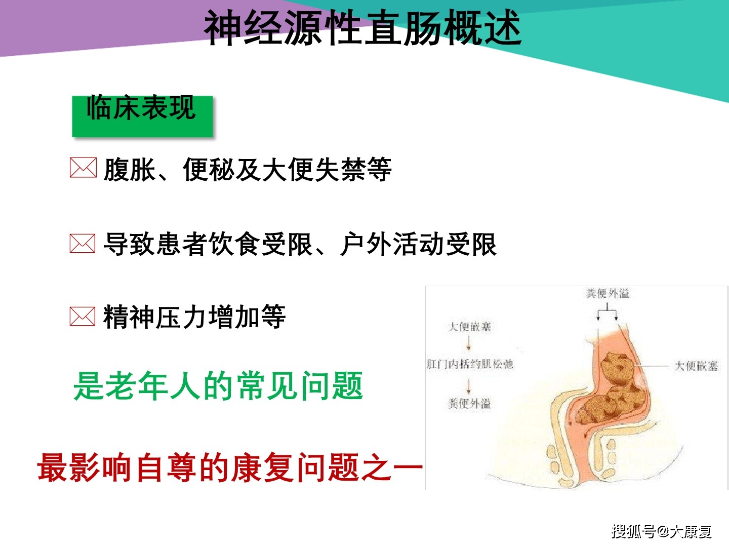 神经源性直肠(neurogenic rectum)是控制直肠功能的中枢神经系统或