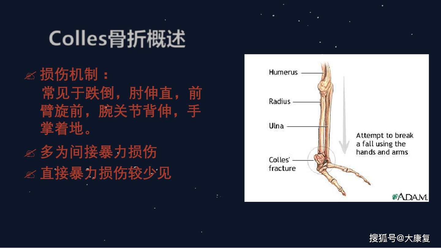 colles骨折术后康复