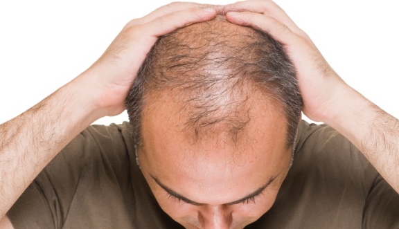 咋样才能不掉头发呢 714198babd5c45c391d7f90248ef759f.jpeg