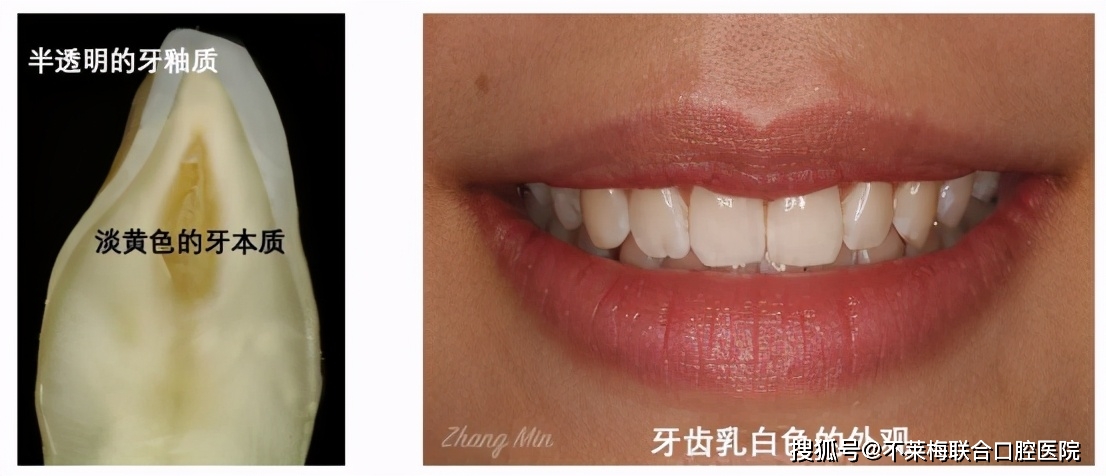 怎么拥有一口白牙 bdbd56b965e64718b5d76429a9285e31.jpeg