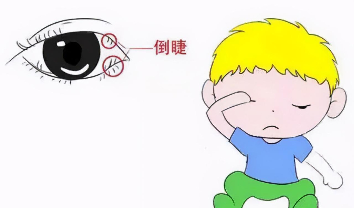 视觉溃劳
