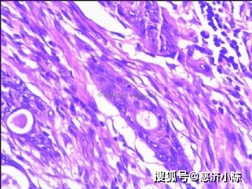 ab6e283965d5443da073d1770e169570.jpeg
