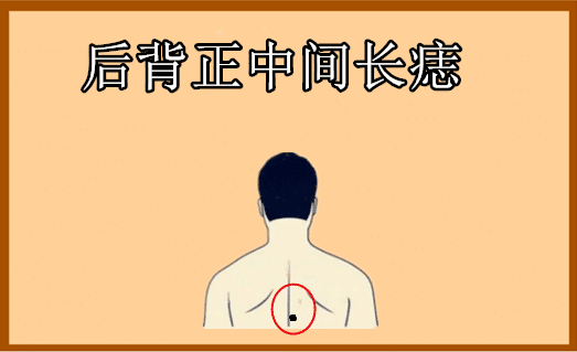 后背正中间长痣在相学当中,若是一个人的后背正中间的位置处长有恶痣